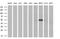Serpin Family B Member 2 antibody, MA5-25777, Invitrogen Antibodies, Western Blot image 