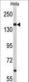 Nucleoporin 153 antibody, LS-C163068, Lifespan Biosciences, Western Blot image 