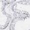 Transmembrane And Coiled-Coil Domains 6 antibody, PA5-57961, Invitrogen Antibodies, Immunohistochemistry paraffin image 