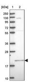 Angiotensin II Receptor Associated Protein antibody, PA5-60617, Invitrogen Antibodies, Western Blot image 