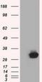 Cilia And Flagella Associated Protein 298 antibody, NBP2-02702, Novus Biologicals, Western Blot image 