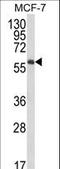 Interleukin 10 Receptor Subunit Alpha antibody, LS-B15873, Lifespan Biosciences, Western Blot image 