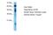 Guanylate Cyclase 1 Soluble Subunit Beta 1 antibody, PA5-42803, Invitrogen Antibodies, Western Blot image 