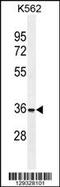 Forkhead Box I3 antibody, 55-877, ProSci, Western Blot image 