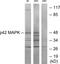 Mitogen-Activated Protein Kinase 1 antibody, LS-C118846, Lifespan Biosciences, Western Blot image 
