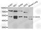Carbonic Anhydrase 14 antibody, A4573, ABclonal Technology, Western Blot image 