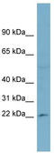 60S ribosomal protein L13a antibody, TA344300, Origene, Western Blot image 