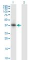 Ring Finger Protein 150 antibody, H00057484-M01, Novus Biologicals, Western Blot image 