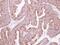 Kelch Like Family Member 2 antibody, PA5-30441, Invitrogen Antibodies, Immunohistochemistry paraffin image 