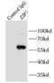 Solute Carrier Family 39 Member 7 antibody, FNab09642, FineTest, Immunoprecipitation image 