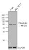 TNF Receptor Superfamily Member 10b antibody, PA1-957, Invitrogen Antibodies, Western Blot image 