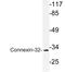 Gap Junction Protein Beta 1 antibody, LS-B12552, Lifespan Biosciences, Western Blot image 