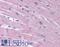 Potassium Two Pore Domain Channel Subfamily K Member 18 antibody, LS-B5066, Lifespan Biosciences, Immunohistochemistry paraffin image 