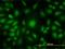 Adenylate Kinase 1 antibody, H00000203-M08, Novus Biologicals, Immunofluorescence image 