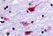 Cholinergic Receptor Muscarinic 2 antibody, MBS244325, MyBioSource, Immunohistochemistry paraffin image 