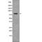 Tumor Protein P73 antibody, abx219067, Abbexa, Western Blot image 