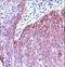 Keratin 6B antibody, LS-C165632, Lifespan Biosciences, Immunohistochemistry frozen image 