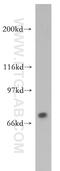 Tigger Transposable Element Derived 1 antibody, 13833-1-AP, Proteintech Group, Western Blot image 