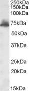 A-Kinase Anchoring Protein 10 antibody, LS-C54469, Lifespan Biosciences, Western Blot image 