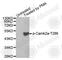 Calcium/Calmodulin Dependent Protein Kinase II Alpha antibody, AP0255, ABclonal Technology, Western Blot image 