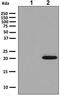 Superoxide Dismutase 2 antibody, ab137037, Abcam, Western Blot image 