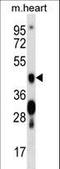 Calcium/Calmodulin Dependent Protein Kinase IV antibody, LS-C164314, Lifespan Biosciences, Western Blot image 