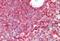 Proteasome Subunit Beta 8 antibody, NBP1-51957, Novus Biologicals, Immunohistochemistry paraffin image 