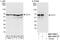 Chaperonin Containing TCP1 Subunit 3 antibody, NBP1-79040, Novus Biologicals, Western Blot image 