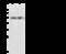 Alpha-1-antiproteinase antibody, GTX02323, GeneTex, Western Blot image 