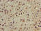 Chromodomain Y Like antibody, orb52266, Biorbyt, Immunohistochemistry paraffin image 