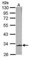 TAR DNA Binding Protein antibody, GTX100579, GeneTex, Western Blot image 