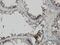 PDZ Binding Kinase antibody, H00055872-M11, Novus Biologicals, Immunohistochemistry frozen image 