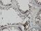 PBK/TOPK antibody, H00055872-M11, Novus Biologicals, Immunohistochemistry frozen image 