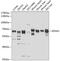 Karyopherin Subunit Alpha 5 antibody, GTX64797, GeneTex, Western Blot image 