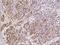S100 Calcium Binding Protein A6 antibody, GTX02202, GeneTex, Immunohistochemistry paraffin image 