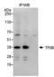 General Transcription Factor IIB antibody, NBP1-49982, Novus Biologicals, Immunoprecipitation image 