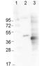 AKT Serine/Threonine Kinase 2 antibody, orb345937, Biorbyt, Western Blot image 