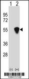 RuvB Like AAA ATPase 1 antibody, 60-400, ProSci, Western Blot image 