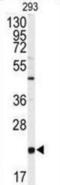 Phosphatidylethanolamine Binding Protein 1 antibody, abx033868, Abbexa, Western Blot image 