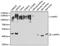 Lysosomal Associated Membrane Protein 1 antibody, GTX33293, GeneTex, Western Blot image 