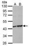 Hypoxia Inducible Factor 1 Subunit Alpha Inhibitor antibody, GTX116251, GeneTex, Western Blot image 