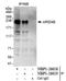 AT-Rich Interaction Domain 4B antibody, NBP1-26619, Novus Biologicals, Immunoprecipitation image 