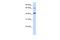 Glutaminyl-Peptide Cyclotransferase Like antibody, A11427, Boster Biological Technology, Western Blot image 