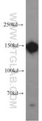 Desmoglein 2 antibody, 21880-1-AP, Proteintech Group, Western Blot image 