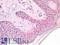 CD63 Molecule antibody, LS-A11975, Lifespan Biosciences, Immunohistochemistry paraffin image 