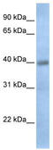 Thioredoxin Domain Containing 15 antibody, TA338668, Origene, Western Blot image 