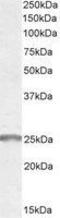 Synaptogyrin 2 antibody, GTX89573, GeneTex, Western Blot image 