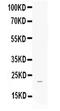 Fibroblast growth factor 21 antibody, PA5-79255, Invitrogen Antibodies, Western Blot image 