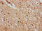 DNA Methyltransferase 1 Associated Protein 1 antibody, CSB-PA873611LA01HU, Cusabio, Immunohistochemistry frozen image 