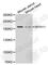 Myosin Heavy Chain 11 antibody, A1498, ABclonal Technology, Western Blot image 